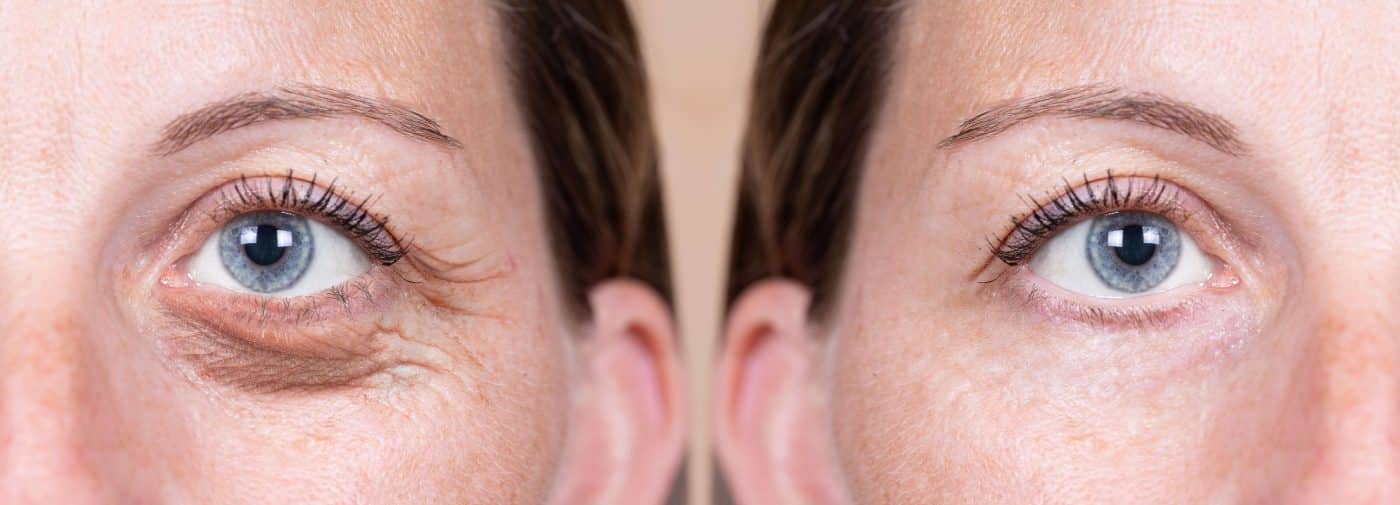Eye care products 1 shutterstock 1454362637 min