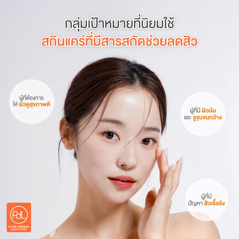 กลุ่มเป้าหมายที่นิยมใช้ในสกินแคร์ที่มีสารสกัดช่วยลดสิว