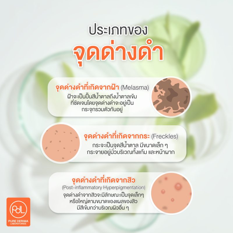 ประเภทของจุดด่างดำ
