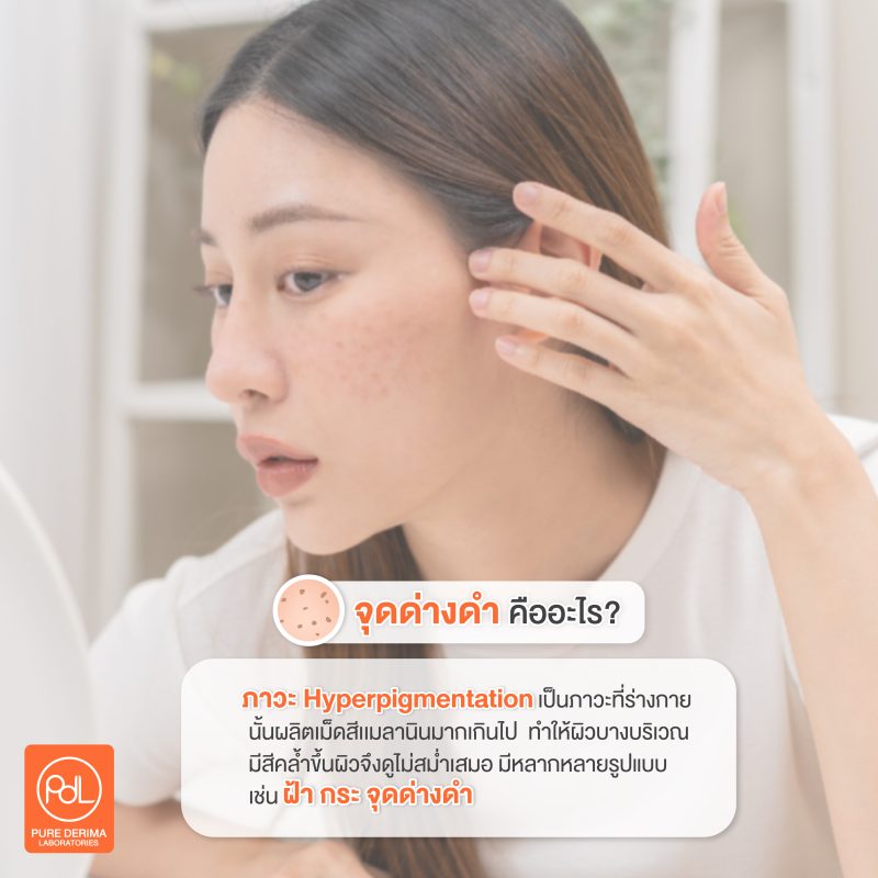 จุดด่างดำคืออะไร