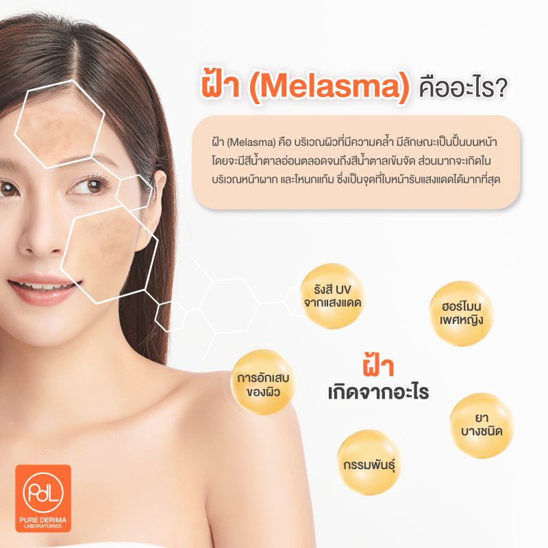 Melasma คืออะไร