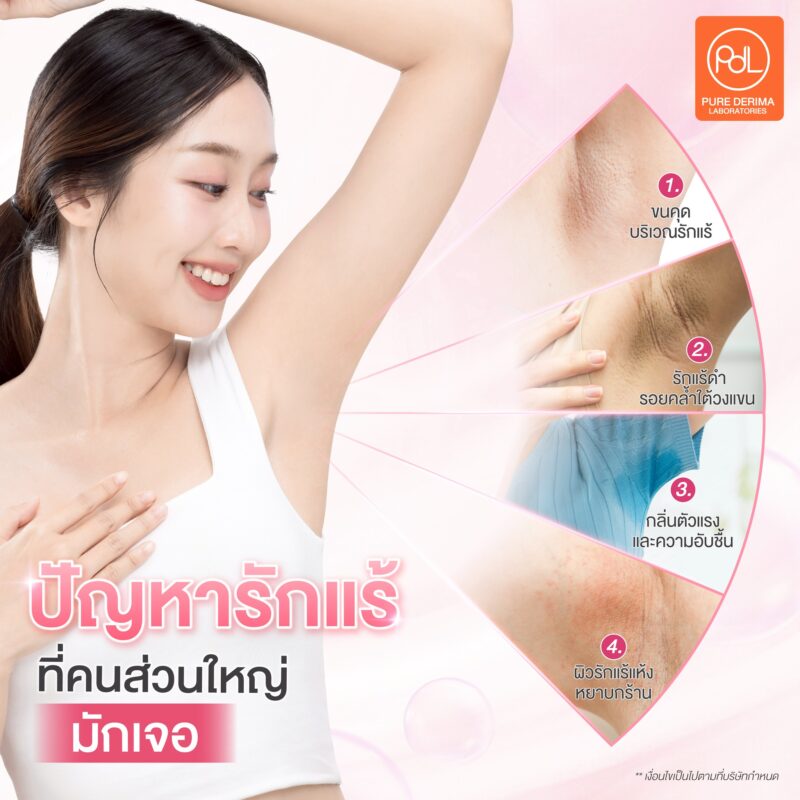 ครีมรักแร้ คืออะไร? รู้จักตัวช่วยดูแลผิวใต้วงแขนให้ดูเรียบเนียน 2 ปัญหารักแร้ที่คนส่วนใหญ่มักเจอ